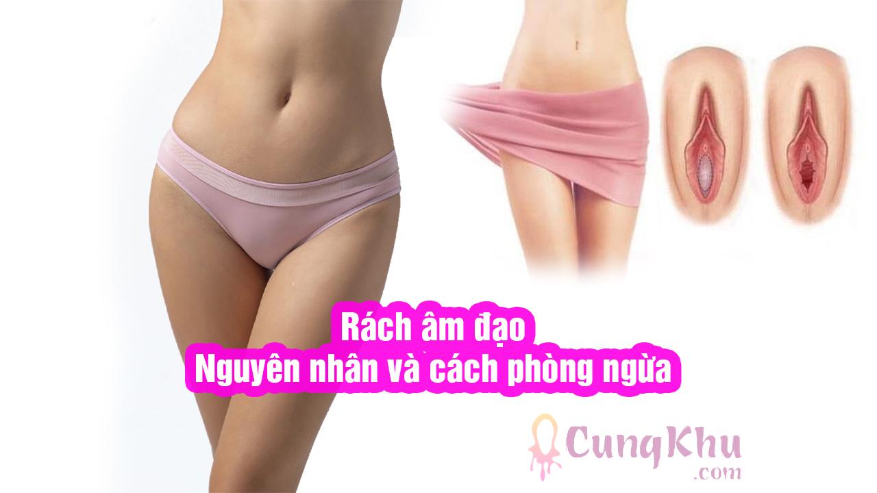 Rách âm đạo, nguyên nhân và cách phòng ngừa